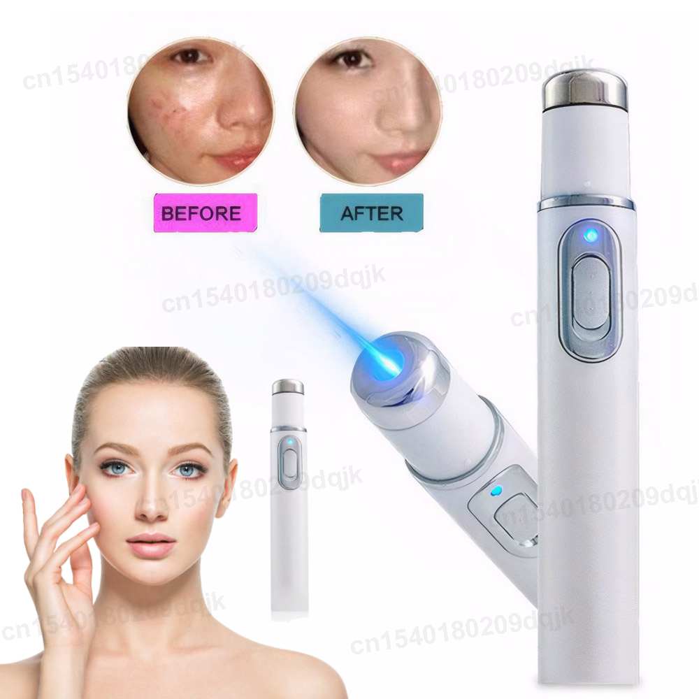 Acne Light Therapy Pen - Mavi Işık Terapisi Akne Kalemi Isıtmalı